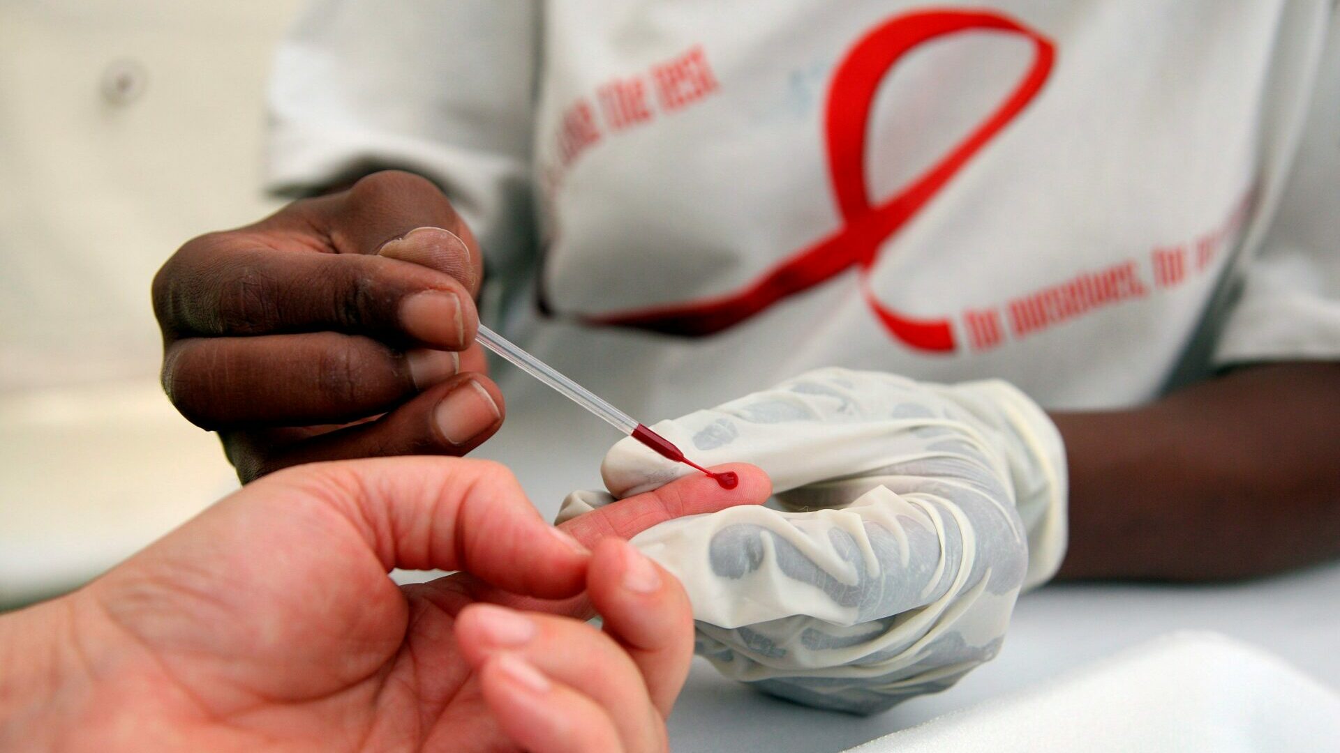 40 años del VIH: ¿Cómo afectó el Covid-19 a esa epidemia?
