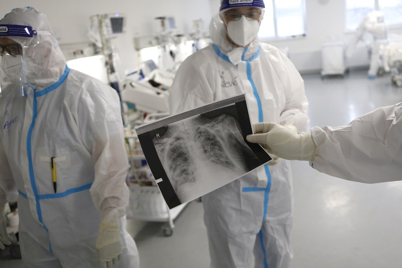 Estudio: Las células pulmonares pueden predecir casos de covid graves