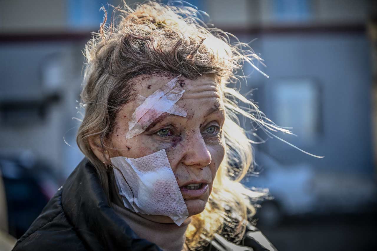 En imágenes: los rostros del conflicto Rusia-Ucrania