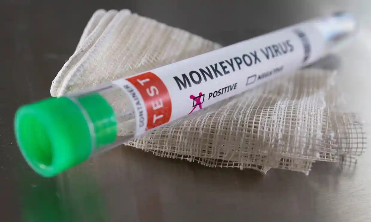 ¿Por qué están surgiendo repentinamente casos de viruela del mono en todo el mundo y es posible que el virus haya mutado?