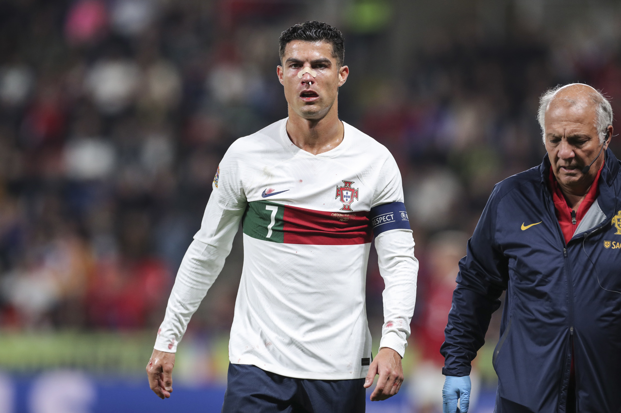 Cristiano Ronaldo sufre duro golpe en victoria de Portugal