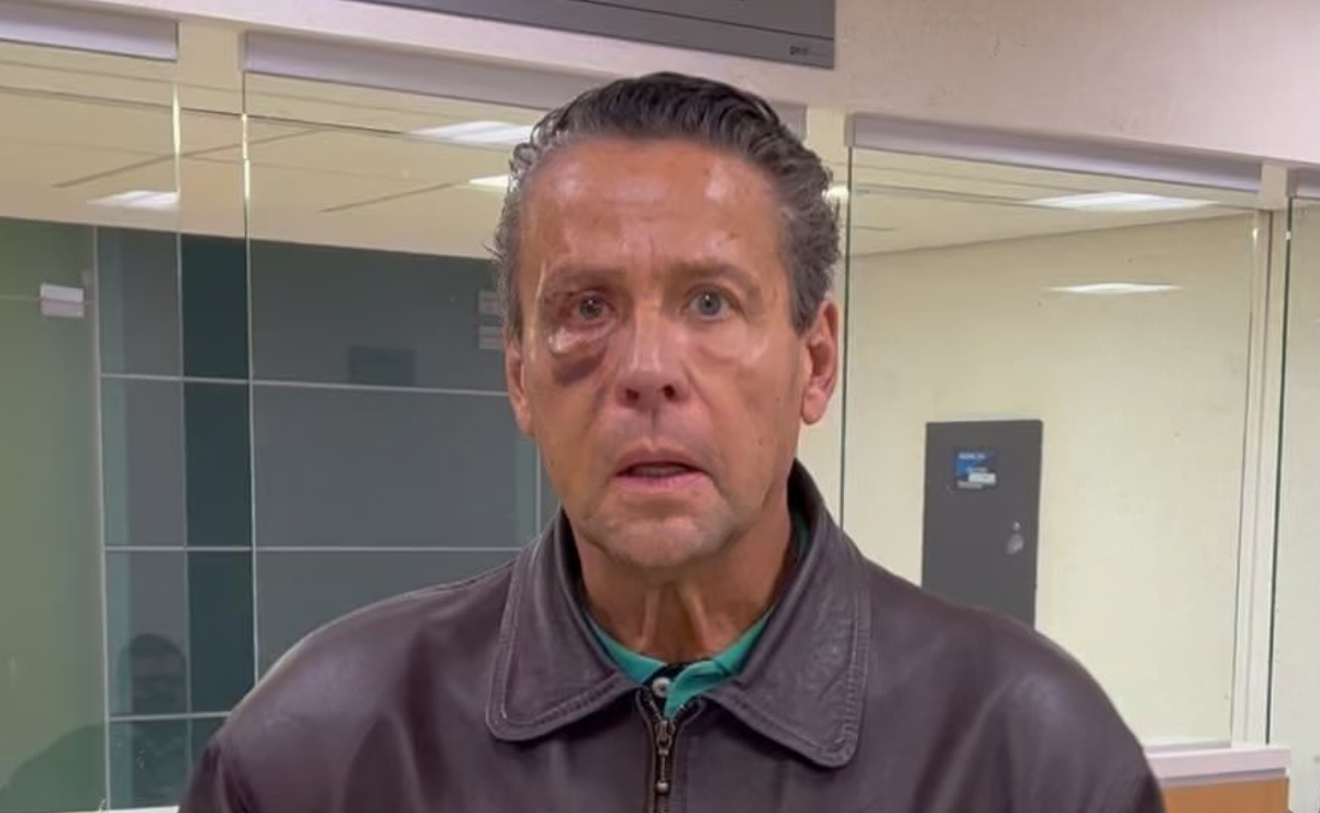 Alfredo Adame asegura que perdió el 30% de visión en su ojo derecho tras golpes