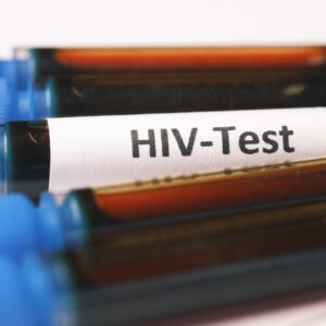 Aumentan ‘significativamente’ contagios de VIH en los últimos 5 años: Estudio