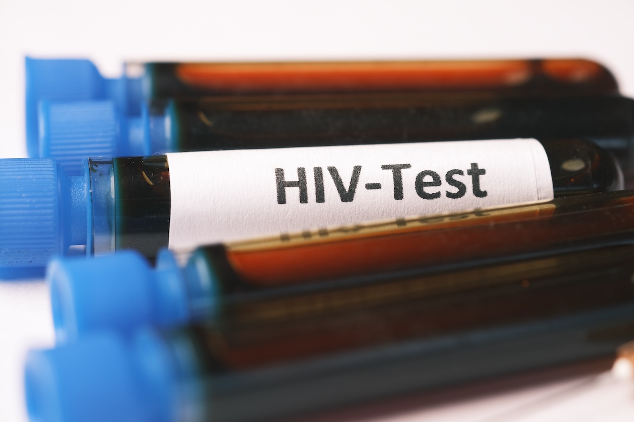 Aumentan ‘significativamente’ contagios de VIH en los últimos 5 años: Estudio