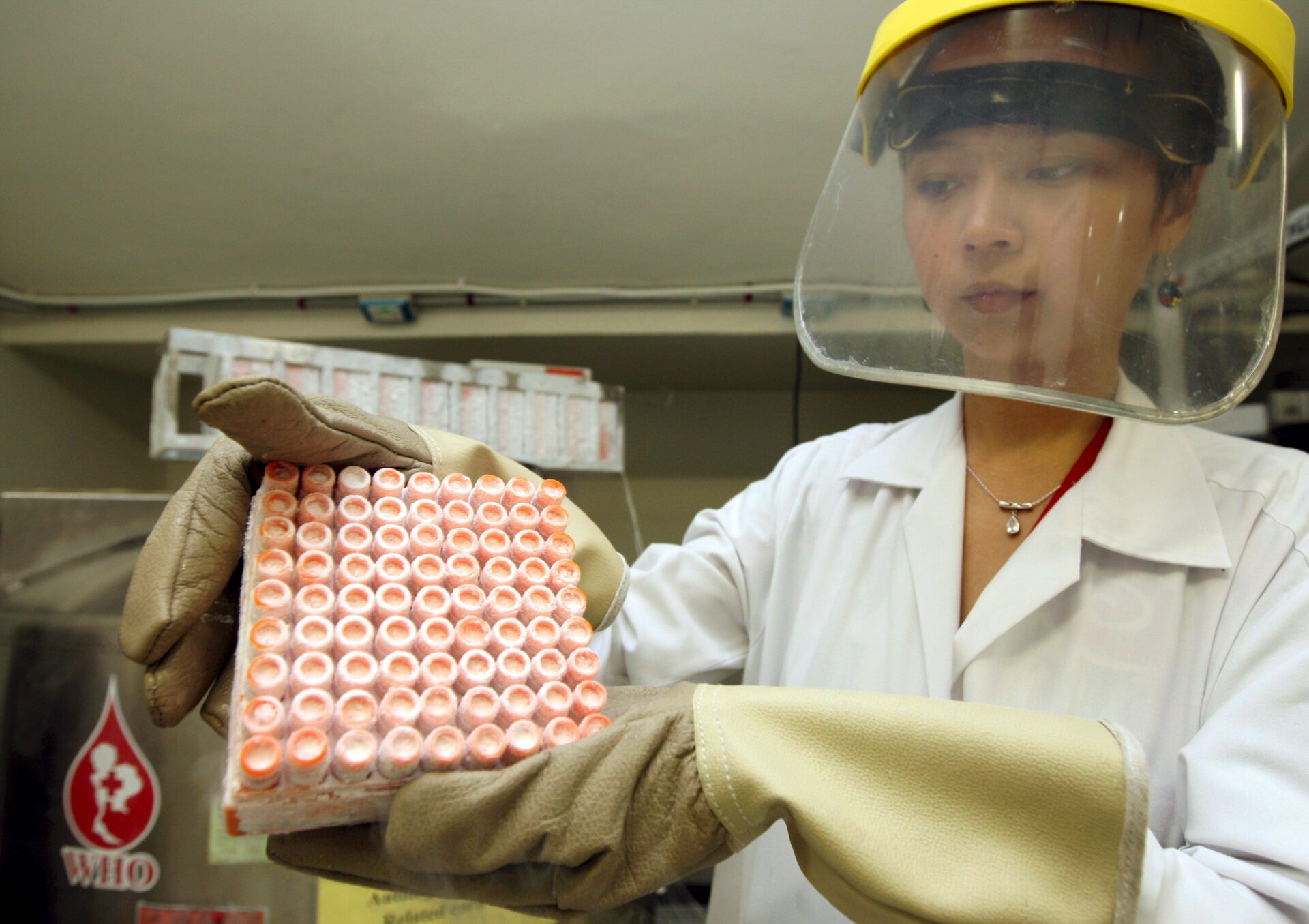 EU registra posible caso de éxito contra el VIH gracias a células madre
