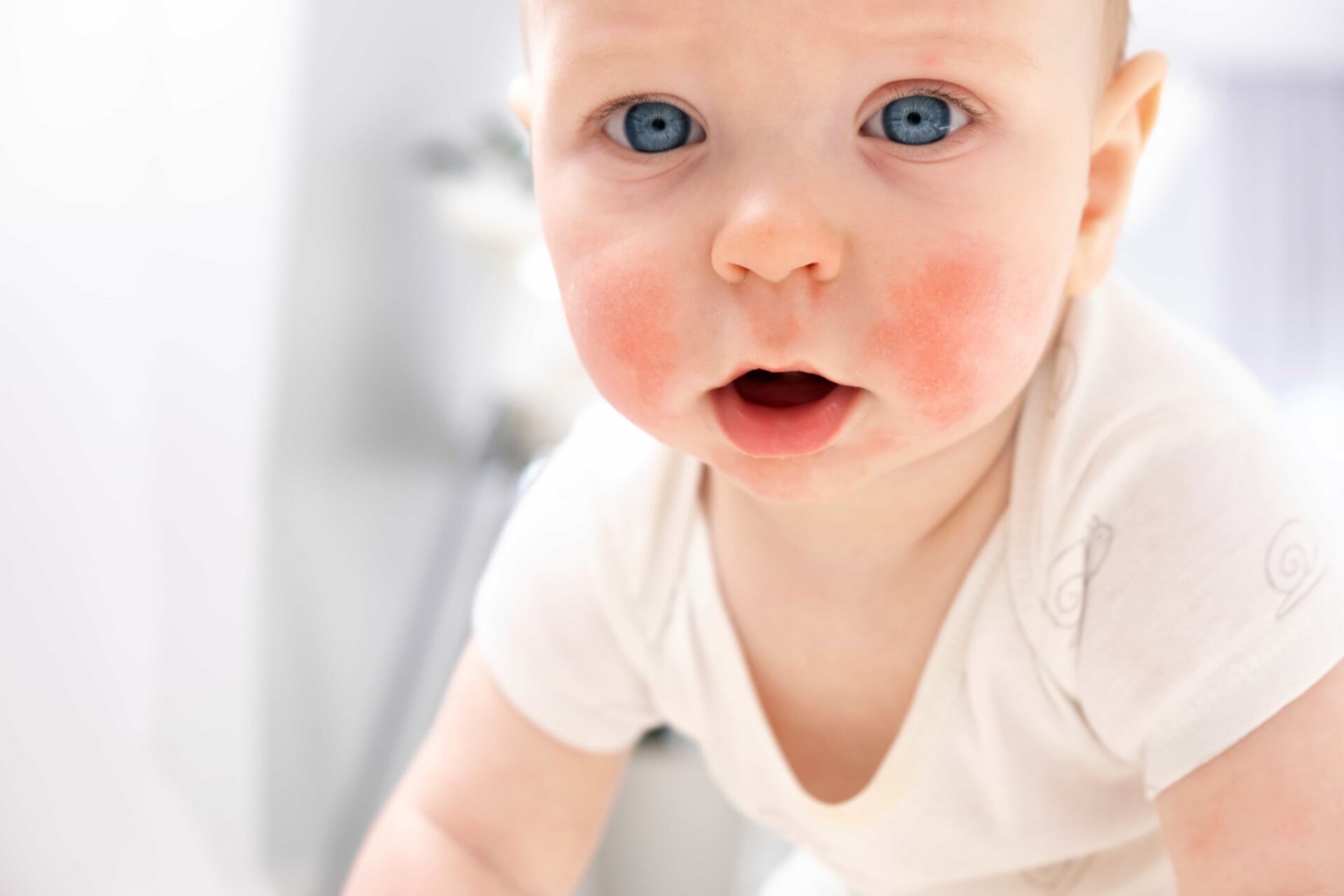 Granitos por calor en bebés, lo que debes saber