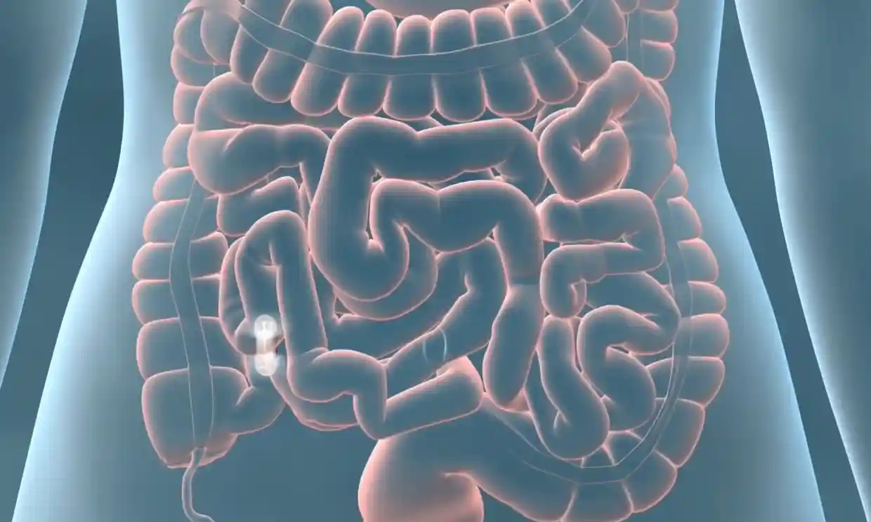 ¿Qué es el cáncer de colon y cómo detectar los primeros síntomas?