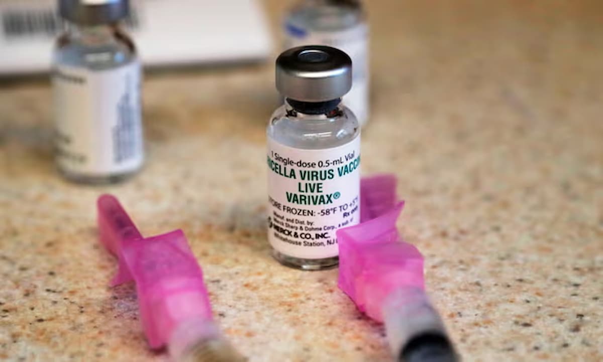 Reino Unido propone vacunas contra la varicela, ¿realmente las necesitamos?