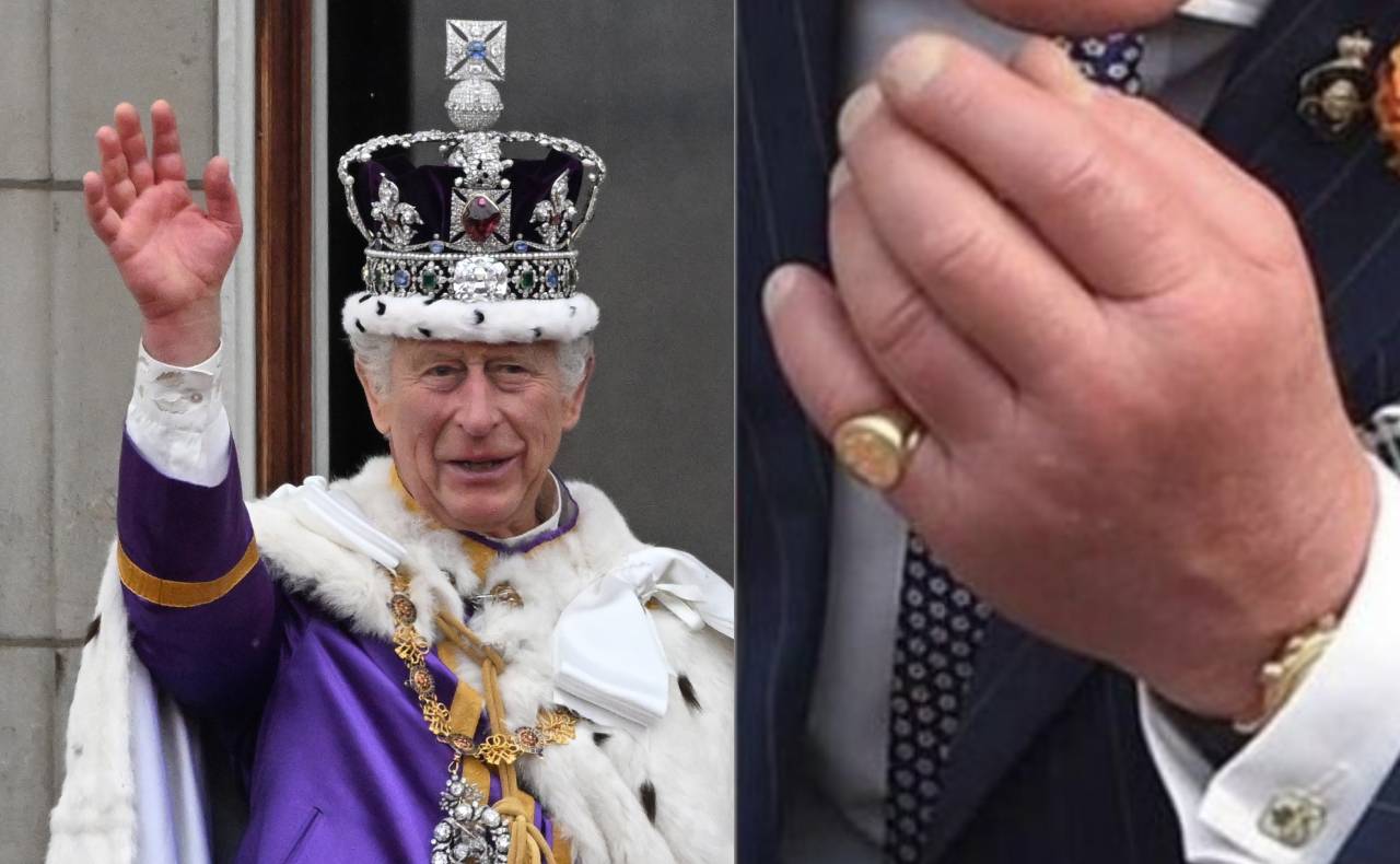 ¿Por qué el rey Carlos III tiene ‘dedos de salchicha’?