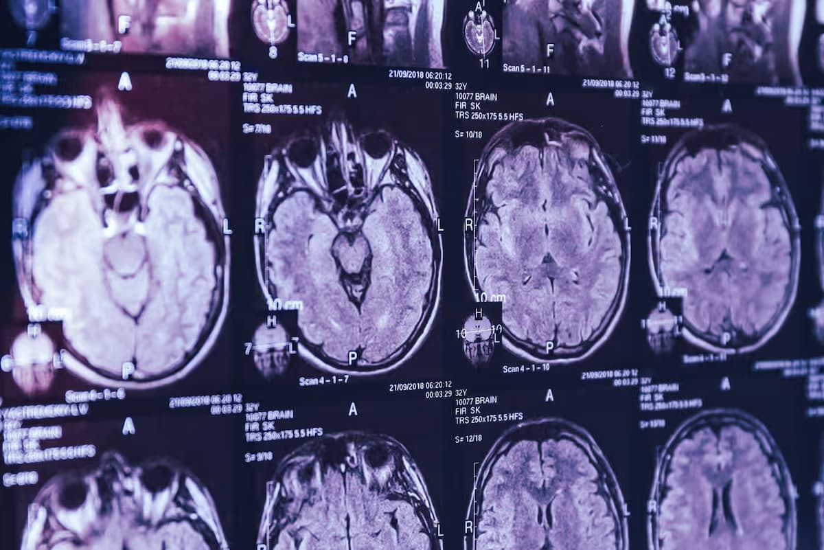 Michael Coulthart denuncia: ‘se me impidió estudiar misteriosa enfermedad cerebral’